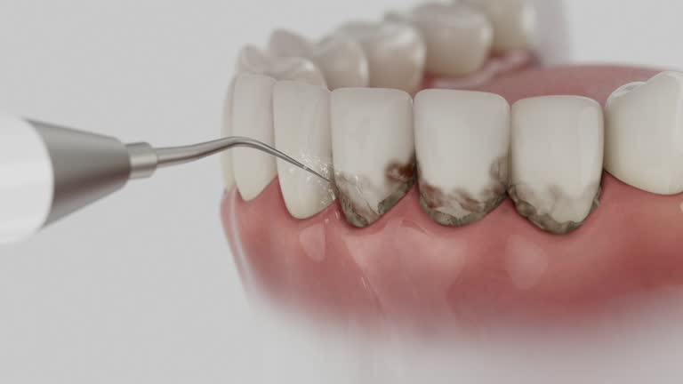 Reliable Dental contractor in Maplewood, WA by Dentist Open Now